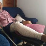 Miquel Ensenyat, en casa tras pasar por el quirófano del Hospital de Son Espases