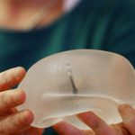 Rechazada la demanda de las mujeres víctimas de implantes mamarios defectuosos