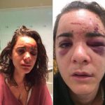 Una estudiante estadounidense, brutalmente violada y agredida en Madrid