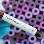 Armengol reclama "más apoyo" al Estado en el suministro de PCR