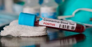 tests expres menorca coronavirus