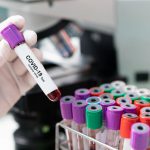 Baleares suma 144 nuevas PCR positivas y ningún fallecido en las últimas 24 horas